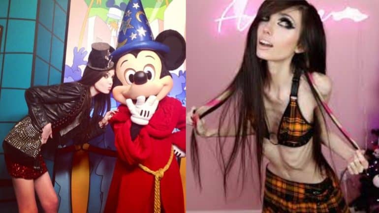 Eugenia Cooney before and after2