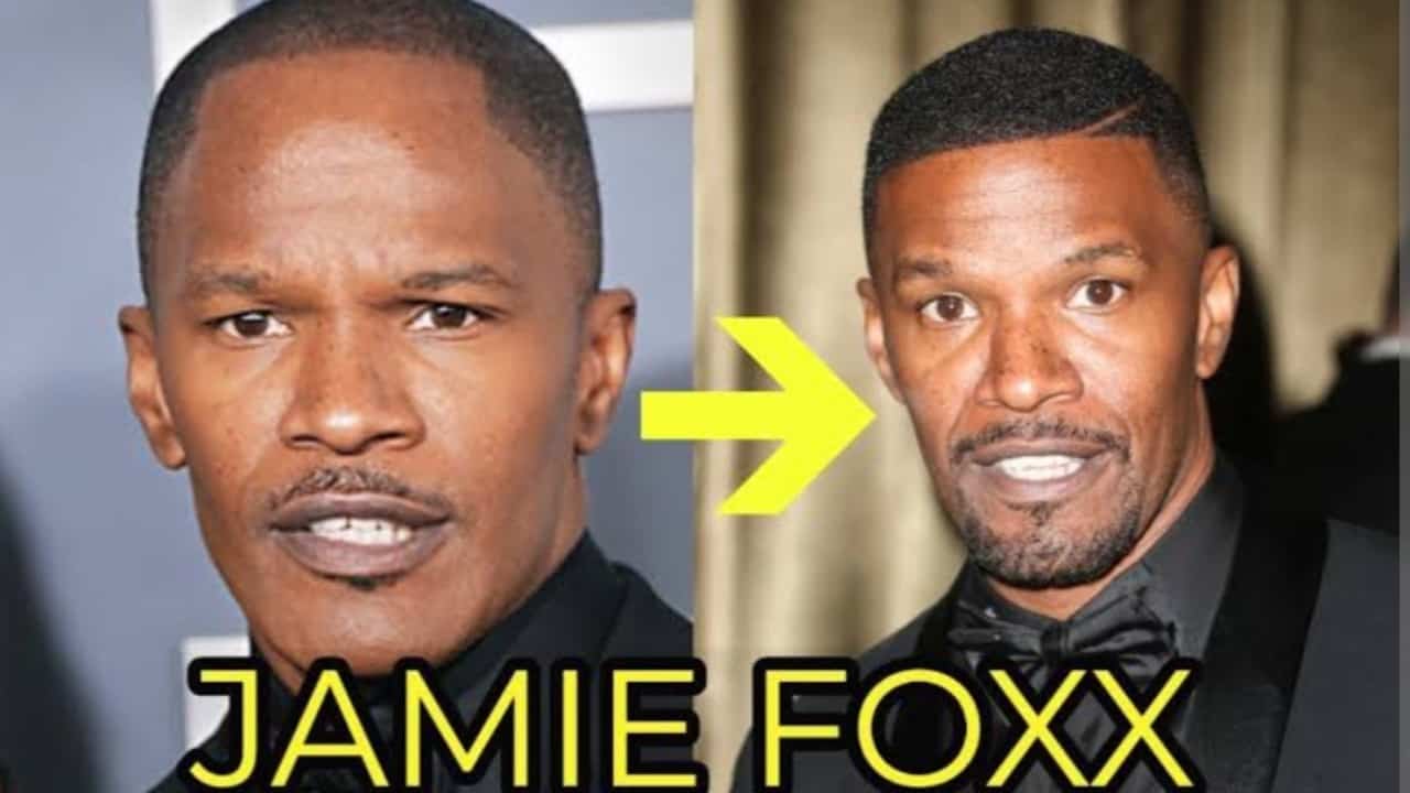 Jamie Foxx before and after